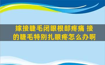 嫁接睫毛闭眼根部疼痛 接的睫毛特别扎眼疼怎么办啊